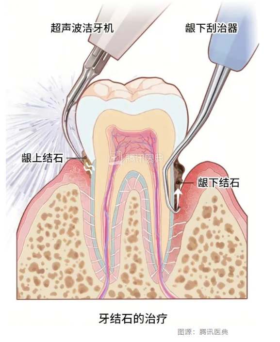 1761036062135631.png 1761036062135631.png