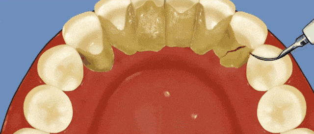 1761036177149320.gif 1761036177149320.gif